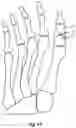 Fig. 16 - Orthopedic bone screw