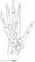 Fig. 18 - Orthopedic bone screw