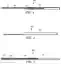 Fig. 02 - Balloon catheter