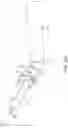 Fig. 16 - Electrosurgical apparatus with robotic tip