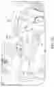 Fig. 20 - Electrosurgical apparatus with robotic tip