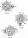 Fig. 16 - Ablation catheter with dedicated fluid paths and needle centering insert