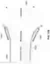 Fig. 44 - Heated vapor ablation systems and methods for treating cardiac conditions