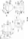 Fig. 85 - Heated vapor ablation systems and methods for treating cardiac conditions