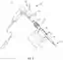Fig. 03 - Spinal implant system and methods of use