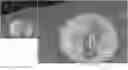 Fig. 01 - Systems and methods for registration of intra-body electrical readings with a pre-acquired three dimensional image