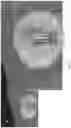 Fig. 07 - Systems and methods for registration of intra-body electrical readings with a pre-acquired three dimensional image