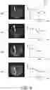 Fig. 05 - Position detection based on tissue discrimination