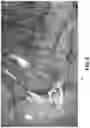 Fig. 11 - Computer vision techniques