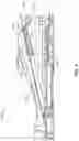 Fig. 06 - Foot controller with adjustable treadle