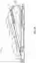 Fig. 07 - Foot controller with adjustable treadle