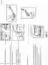 Fig. 02 - Kinematically aligned robotic total knee arthroplasty