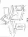 Fig. 06 - Kinematically aligned robotic total knee arthroplasty