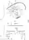 Fig. 07 - Tissue expansion device