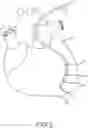 Fig. 03 - System and Method for Local Deformable Registration of a Catheter Navigation System to Image Data or a Model