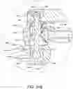 Fig. 64 - Surgical equipment holder