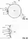 Fig. 05 - Endodontic instruments and root canal treatment methods