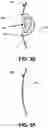Fig. 06 - Endodontic instruments and root canal treatment methods