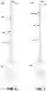 Fig. 08 - Endodontic instruments and root canal treatment methods