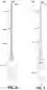 Fig. 09 - Endodontic instruments and root canal treatment methods