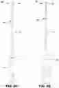 Fig. 11 - Endodontic instruments and root canal treatment methods