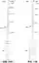 Fig. 13 - Endodontic instruments and root canal treatment methods