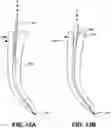 Fig. 15 - Endodontic instruments and root canal treatment methods