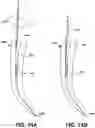 Fig. 17 - Endodontic instruments and root canal treatment methods