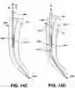 Fig. 18 - Endodontic instruments and root canal treatment methods