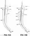Fig. 20 - Endodontic instruments and root canal treatment methods