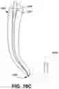 Fig. 23 - Endodontic instruments and root canal treatment methods