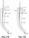 Fig. 24 - Endodontic instruments and root canal treatment methods