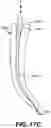 Fig. 25 - Endodontic instruments and root canal treatment methods