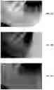 Fig. 36 - Endodontic instruments and root canal treatment methods