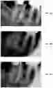 Fig. 40 - Endodontic instruments and root canal treatment methods