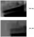 Fig. 43 - Endodontic instruments and root canal treatment methods