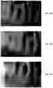 Fig. 45 - Endodontic instruments and root canal treatment methods