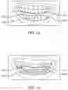 Fig. 22 - Automated 2D/3D integration and lip spline autoplacement