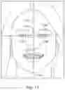 Fig. 25 - Automated 2D/3D integration and lip spline autoplacement