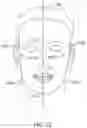Fig. 30 - Automated 2D/3D integration and lip spline autoplacement