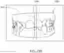 Fig. 35 - Automated 2D/3D integration and lip spline autoplacement