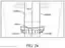 Fig. 36 - Automated 2D/3D integration and lip spline autoplacement