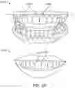 Fig. 38 - Automated 2D/3D integration and lip spline autoplacement