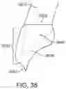 Fig. 52 - Automated 2D/3D integration and lip spline autoplacement