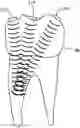 Fig. 01 - Device and Method for Accelerating Orthodontic Treatment Using Mechanical Vibrations