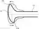 Fig. 01 - Orthodontic device