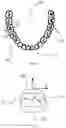 Fig. 02 - Orthodontic device
