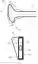 Fig. 05 - Orthodontic device