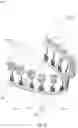 Fig. 10 - Teeth repositioning systems and methods