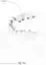Fig. 17 - Teeth repositioning systems and methods